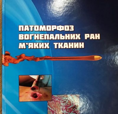 Патоморфоз вогнепальних ран м’яких тканин