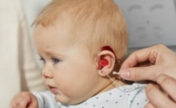 Розпочалось проведення операцій дітям з вадами слуху, які зареєстровані у черзі на кохлеарну імплантацію