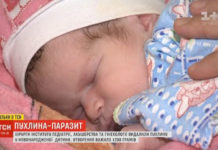В Інституті педіатрії, акушерства та гінекології ім. О.М. Лук’янової НАМН України лікарі видалили пухлину, що важила майже половину новонародженої дитини