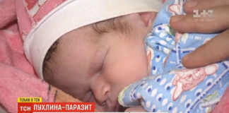 В Інституті педіатрії, акушерства та гінекології ім. О.М. Лук’янової НАМН України лікарі видалили пухлину, що важила майже половину новонародженої дитини