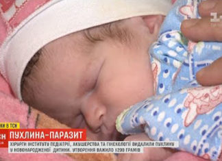 В Інституті педіатрії, акушерства та гінекології ім. О.М. Лук’янової НАМН України лікарі видалили пухлину, що важила майже половину новонародженої дитини