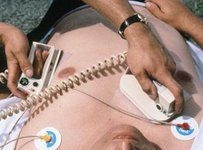 Раптова серцева смерть — епідемія XXI сторіччя