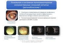 Способи діагностики та лікування доброякісних та злоякісних новоутворень кон’юнктиви у дітей