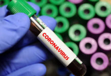 Інформація щодо нового коронавірусу 2019-nCoV та нової коронавірусної хвороби (COVID-19)