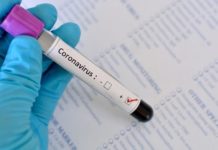 COVID-19 і цукровий діабет