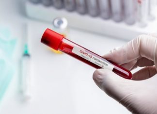 Інформація щодо нової коронавірусної хвороби (COVID-19) станом на 10 годину ранку 31.03.2020р.