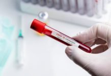 Коронавірус SARS-CoV-2: загадковий порушник законів епідеміології