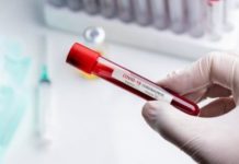 Інформація щодо COVID-19 станом на 10:00 8.04.2020 р.