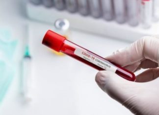 Інформація щодо COVID-19 станом на 10:00 8.04.2020 р.