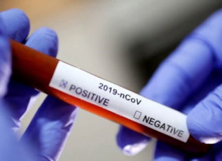 Інформація щодо COVID-19 станом на 21.04.2020 р.