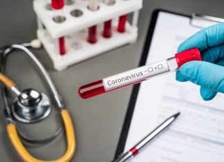 Інформація щодо COVID-19 станом на 10:00 13.04.2020 р.