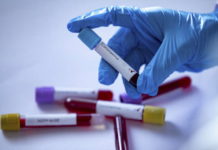 Інформація щодо COVID-19 станом на 10:00 10.04.2020 р.