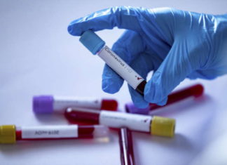 Інформація щодо COVID-19 станом на 10:00 10.04.2020 р.