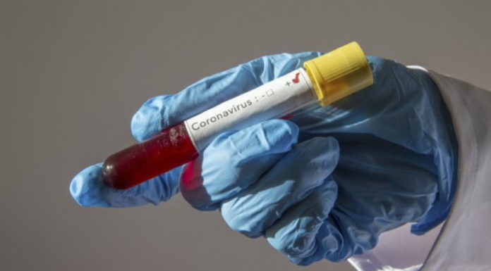 Інформація щодо COVID-19 станом на 15.04.2020 р.