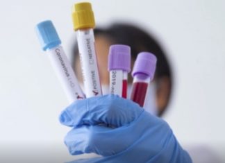 Інформація щодо COVID-19 станом на 10 годину ранку 1.04.2020 р.