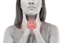 Радіочастотна абляція раку щитоподібної залози. Клінічний випадок