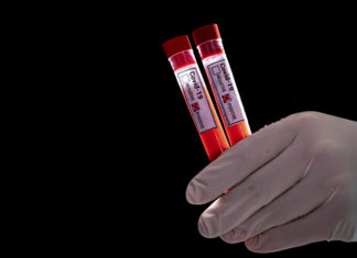 Інформація щодо нового коронавірусу COVID-19 станом на 10:00 03.04.2020р.