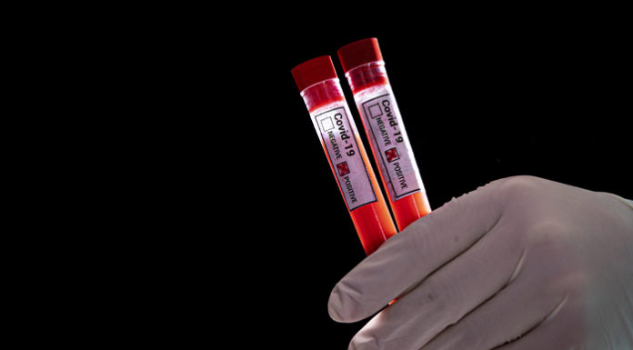 Інформація щодо нового коронавірусу COVID-19 станом на 10:00 03.04.2020р.