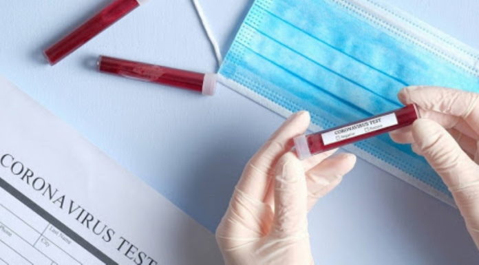 Інформація щодо COVID-19 станом на 10:00 6.04.2020 р.