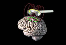 Ритмічна транскраніальна магнітна стимуляція