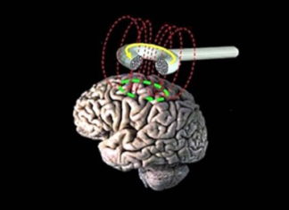 Ритмічна транскраніальна магнітна стимуляція