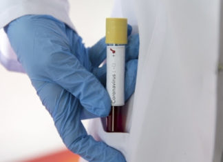 Інформація щодо COVID-19 станом на 10:00 7.04.2020 р.