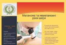 15 травня – День меланоми в Україні