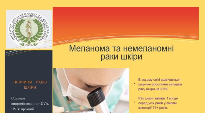 15 травня – День меланоми в Україні