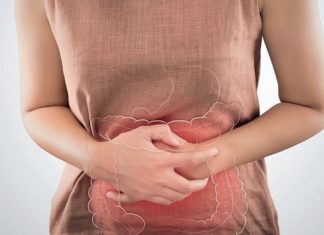 Синдром подразненого кишечника