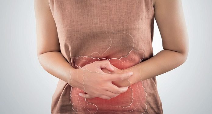 Синдром подразненого кишечника