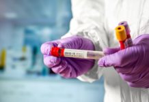 Інформація щодо COVID-19 станом на 22.05.2020 р.