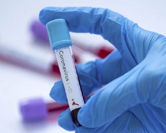 Інформація щодо COVID-19 станом на 3.07.2020 р.