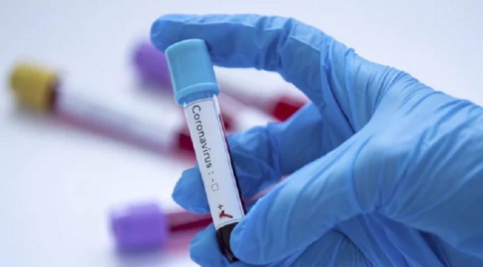 Інформація щодо COVID-19 станом на 25.05.2020 р.