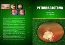 Надрукована монографія «Ретинобластома»