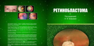 Надрукована монографія «Ретинобластома»