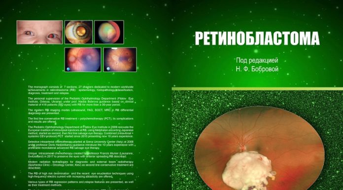 Надрукована монографія «Ретинобластома»