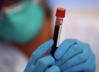 Інформація щодо COVID-19 станом на 10.06.2020 р.