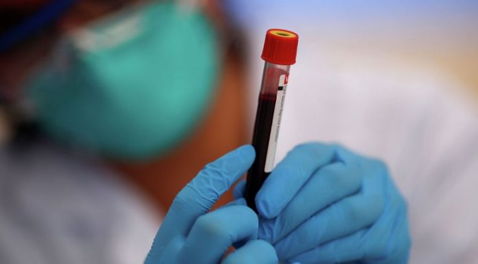 Інформація щодо COVID-19 станом на 21.07.2020 р.