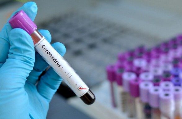 Інформація щодо COVID-19 станом на 23.06.2020 р.