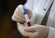 Інформація щодо COVID-19 станом на 16.06.2020 р.