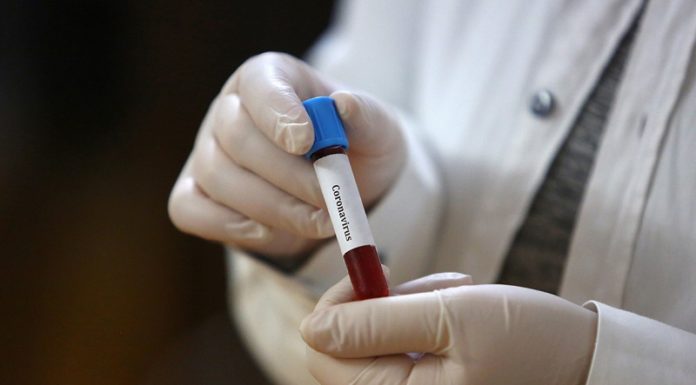 Інформація щодо COVID-19 станом на 20.07.2020 р.