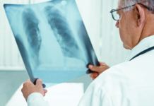 Реформа протитуберкульозної служби має супроджуватися сучасним лікуванням хворих