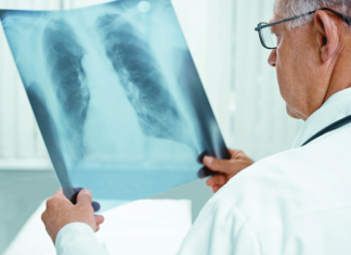 Реформа протитуберкульозної служби має супроджуватися сучасним лікуванням хворих