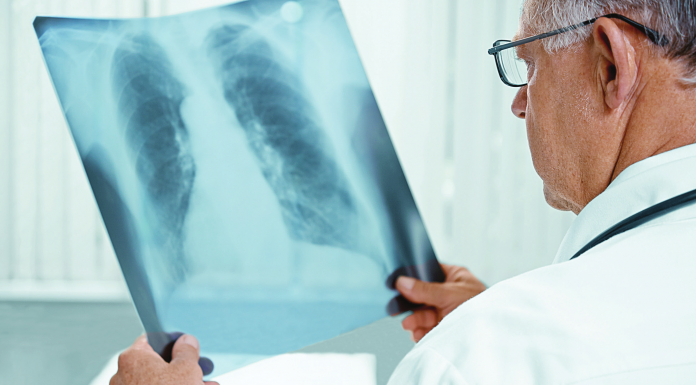 Реформа протитуберкульозної служби має супроджуватися сучасним лікуванням хворих