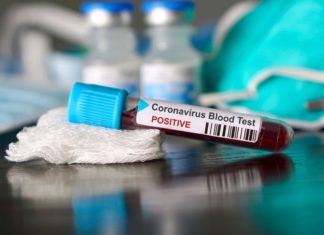 Інформація щодо COVID-19 станом на 2.06.2020 р.