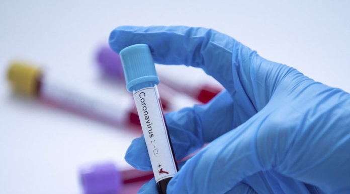 Інформація щодо COVID-19 станом на 10.07.2020 р.