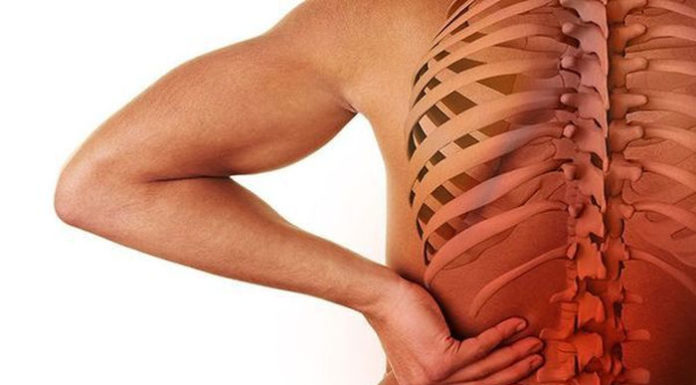 Остеохондроз поперекового відділу хребта. Протрузії міжхребцевих дисків LIII–LIV, LIV–LV. Спондилоартроз у сегментах LIV–LV, LV–SI. Стійкий та виражений синдром спондилоартралгії. Клінічний приклад