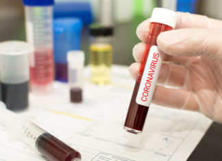 Інформація щодо COVID-19 станом на 9.07.2020 р.