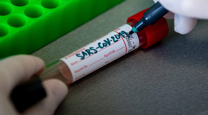 Інформація щодо COVID-19 станом на 2.07.2020 р.