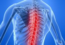 Інволютивний остеопороз. Компресійні, неускладнені переломи тіл Th11, Th12 хребців. Полісегментарний спондилоартроз. Артроз крижово-клубових суглобів.Клінічний приклад